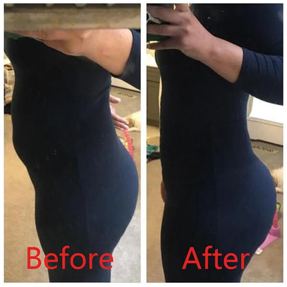 Shapewear Women Full Body Shaper Slimming Bodysuit Open Crotch Corset Waist Trainer Shaping Underwear Butt Lifter Lingerie Fajas
