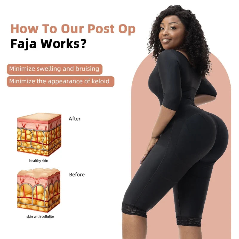360° Full Body Lipo Post-op Recovery Shapewear Bodysuit Thigh And Arm Trainer Butt Lifter Tummy Control Body Shaper With Bra
